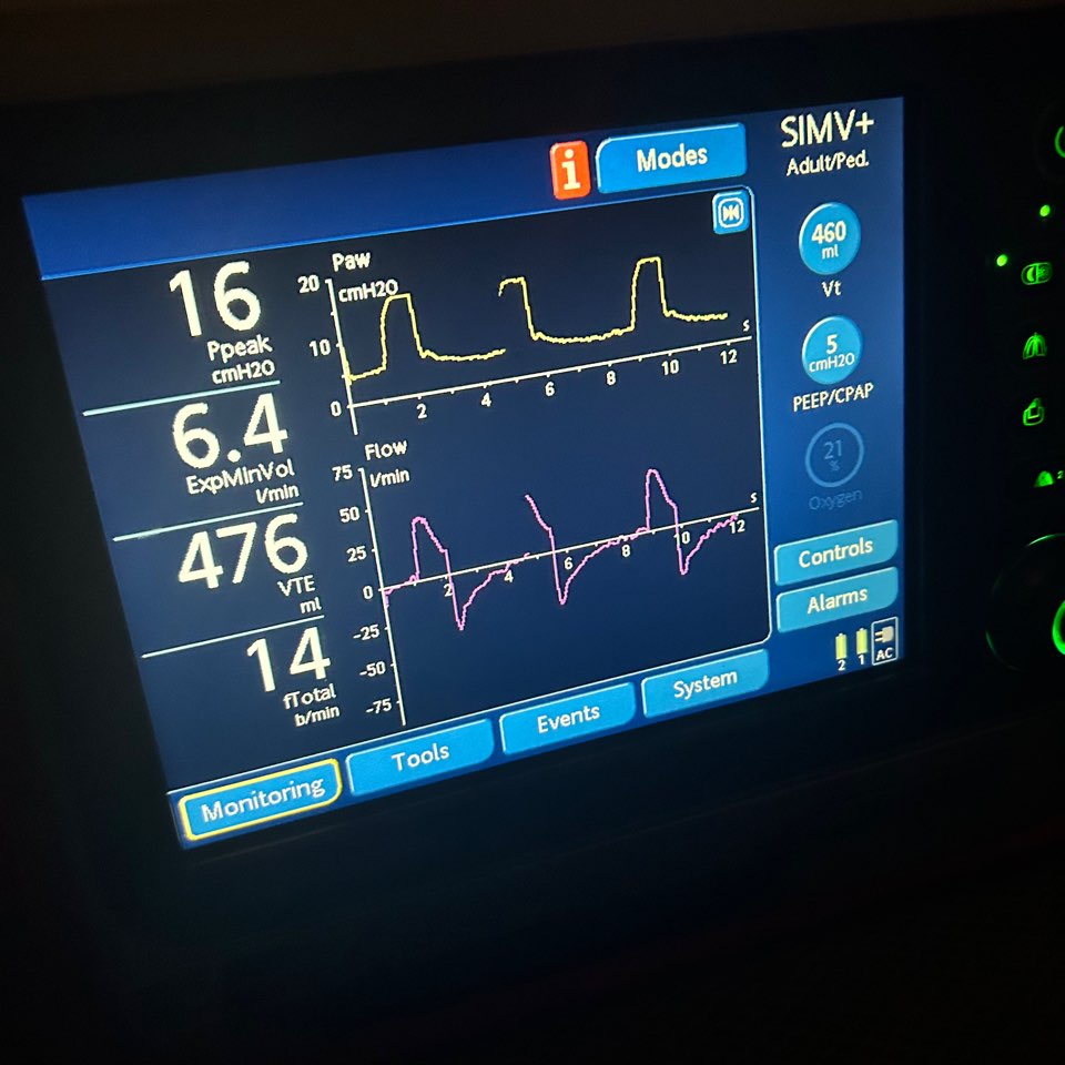 플라잉닥터스 뇌출혈환자 방콕에서 한국으로 이송완료